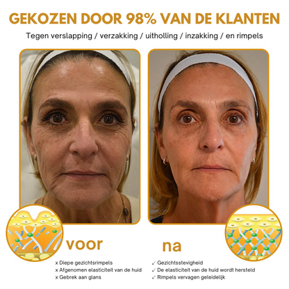 BeeBotox| Botox Effect Rimpelverwijdering Crème