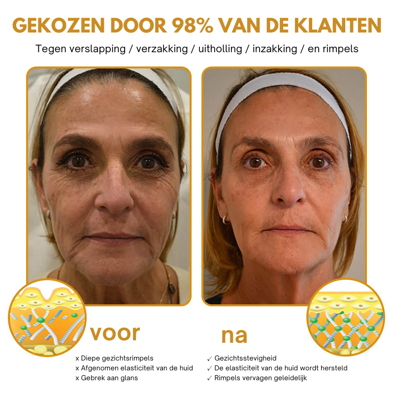 BeeBotox| Botox Effect Rimpelverwijdering Crème