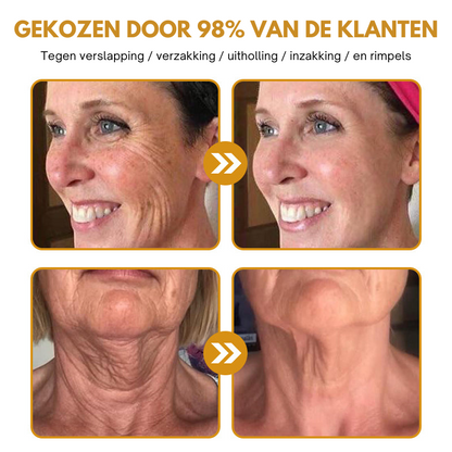 BeeBotox| Botox Effect Rimpelverwijdering Crème